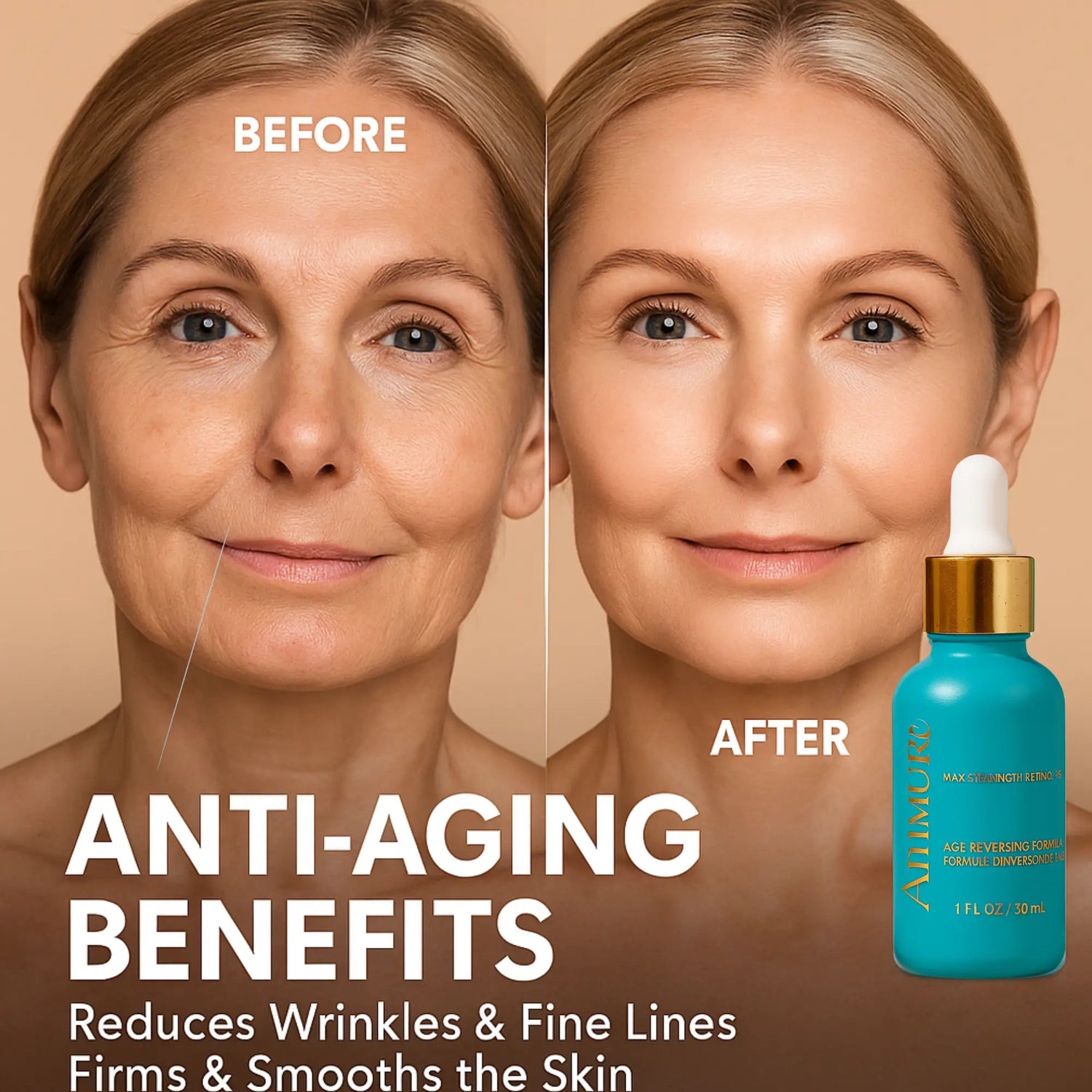Ammuri Skincare 5%Retinol MAX Powerful Anti-Aging Serum for Youthful Skin-1